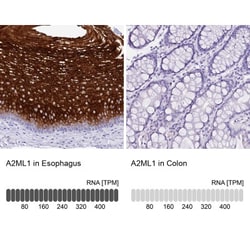alpha 2-Macroglobulin-like 1/A2ML1 Antibody, Novus Biologicals 25 &mu;L | Buy Online | Novus Biologicals | Fisher Scientific